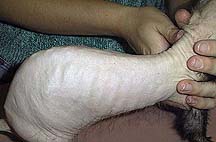 Alopecia 2
