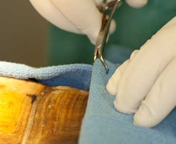 Surgeon clamping the drape