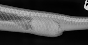 Radiograph showing the impaction