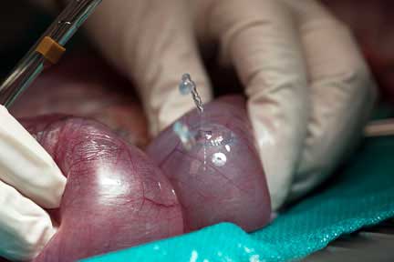 Fluid coming out of distended uterus