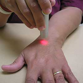 Staff using laser on hand