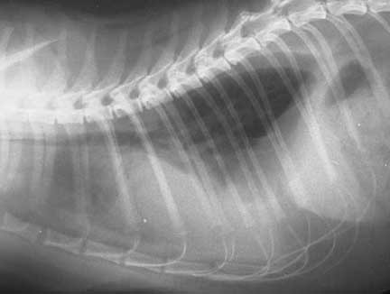 X-ray of the chest after some of the fluid is removed
