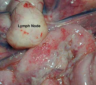 An enlarged lymph node found at necropsy