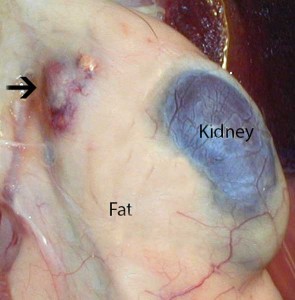 Arrow pointing to inflamed adrenal gland