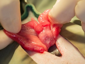 Uterus in surgeon's hands