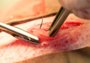 Suturing muscle incision
