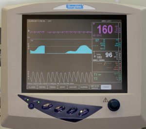Screen of anesthetic monitor showing heart rate and respiratory rate
