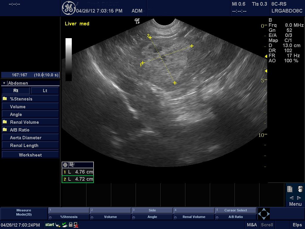 Canine liver ultrasound.