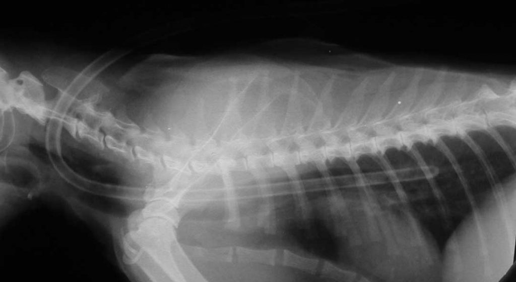 X-ray showing proper placement of a phrayngostomy tube.