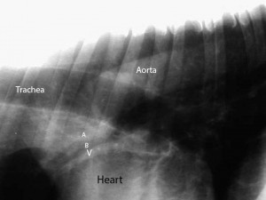 X-ray Close Up Of Aorta, Heart, And Trachea