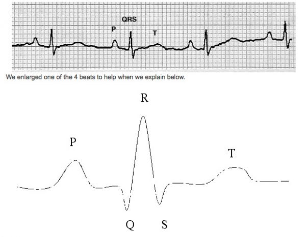 Addison's Disease in Cats (hypoadrenocorticism)