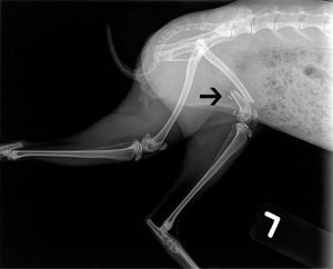 Arrow pointing to fractured femur