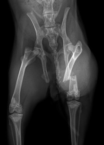 X-ray of fractured femur