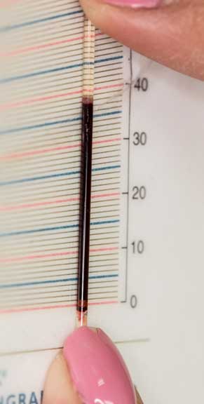 microhematocrit tubes filled with blood.