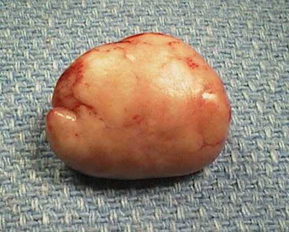 Rat mammary tumor after removal.