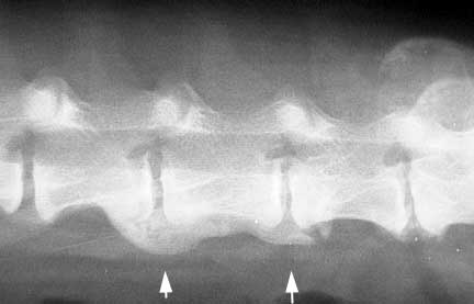 Xray of Arthritis in the Spine Called Spondylosis