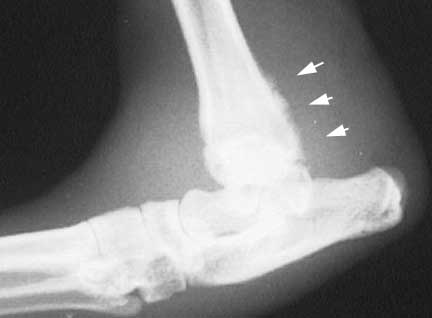 Xray of Bone Infection in a Dog