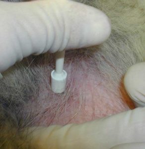 Using Biopsy Punch In The Skin