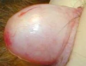 Cat testicle after removal