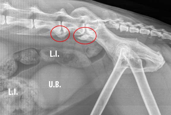X-ray of spine arthritis