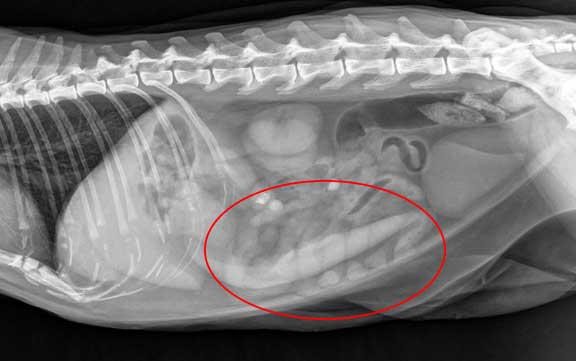 X-Ray of abdomen