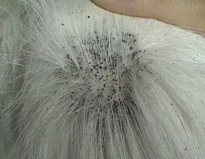 Black Flea Dirt On A Dog With A White Hair Coat