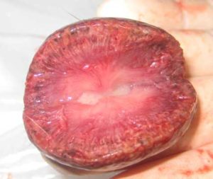 Inside of kidney