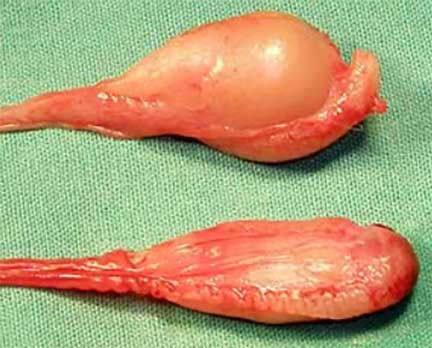 Normal testicle compared to an atrophied testicle