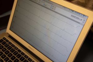EKG Reading On Computer Screen