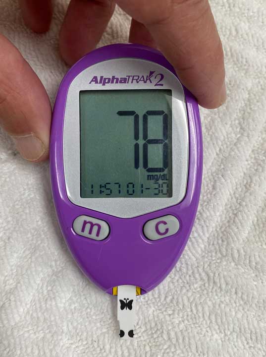 blood-glucose-test result of 78