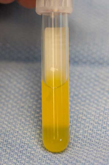 Straw Colored FIP Fluid