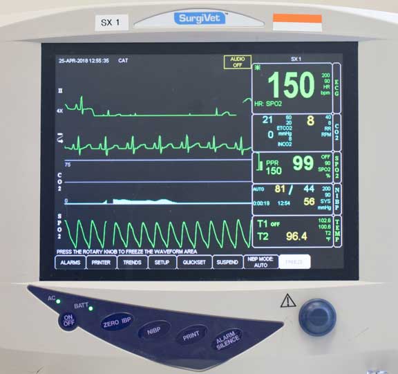 Anesthetic monitor showing heart rate and respiratory rate