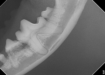 X-ray of jaw showing tooth