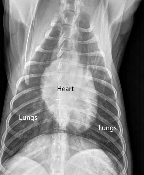 Labeled X-ray of a normal heart