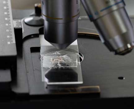 Skin scraping slide on the microscope.