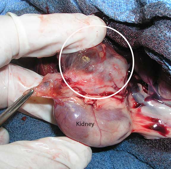 Enlarged adrenal gland