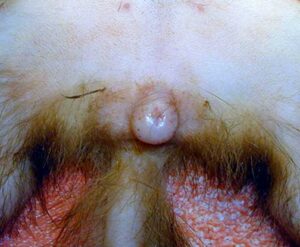 Female ferret with an enlarged vulva.