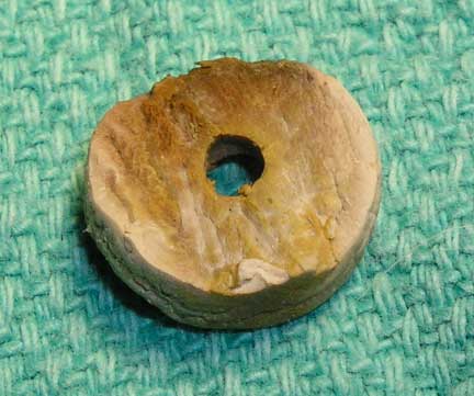 Circular foreign body.