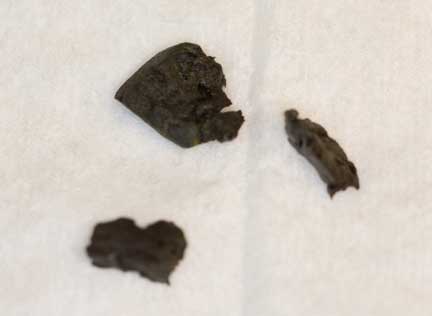 Plastic pieces from ferret intestine