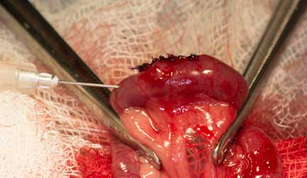 Pressure testing the intestines.