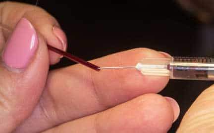Hematocrit tube being filled with blood
