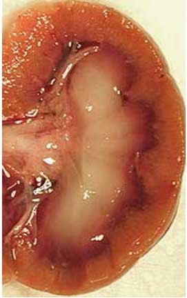 Cut section of a kidney