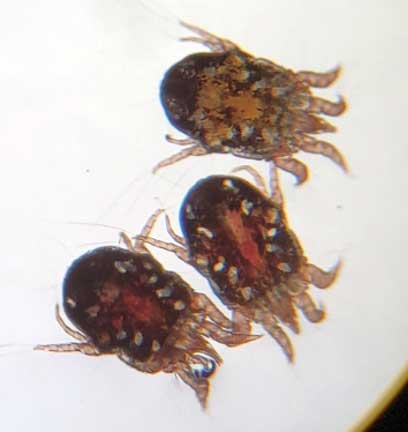 Mange mites under microscope