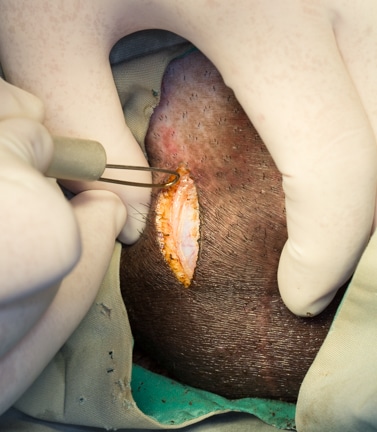 Pot bellied pig laser scrotal incision.