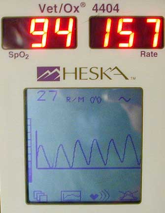 Pulse Oximeter showing an oxygen saturation of 94%
