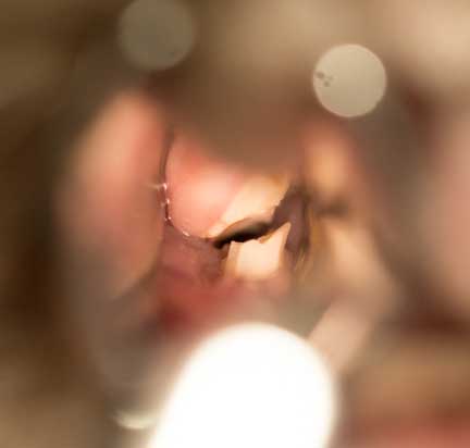 Rabbit with overgrown points on molar teeth.