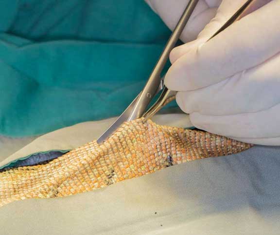 Surgeon making initial skin incision