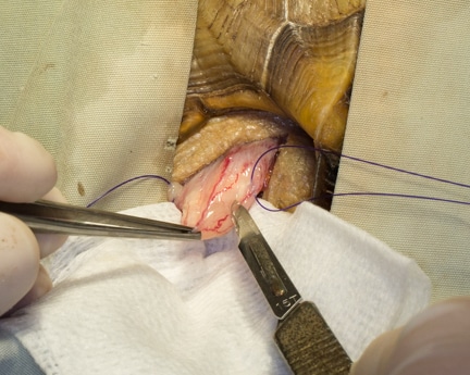 Exteriorizing bladder and placing stay sutures