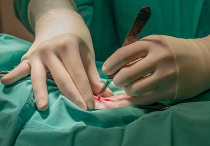 Surgeon making incision