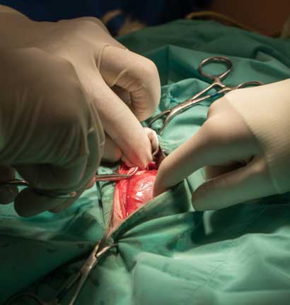 Surgeon finding uterus